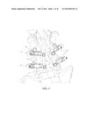 PEDICLE SCREW AND MULTI-AXIAL CONNECTOR SYSTEM diagram and image