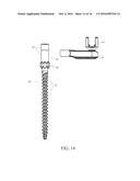 PEDICLE SCREW AND MULTI-AXIAL CONNECTOR SYSTEM diagram and image