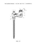 PEDICLE SCREW AND MULTI-AXIAL CONNECTOR SYSTEM diagram and image