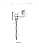 PEDICLE SCREW AND MULTI-AXIAL CONNECTOR SYSTEM diagram and image