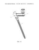 PEDICLE SCREW AND MULTI-AXIAL CONNECTOR SYSTEM diagram and image