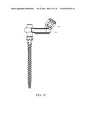 PEDICLE SCREW AND MULTI-AXIAL CONNECTOR SYSTEM diagram and image