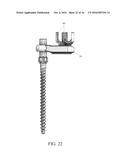 PEDICLE SCREW AND MULTI-AXIAL CONNECTOR SYSTEM diagram and image