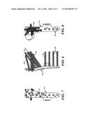 Bone Plate System for Repair of Proximal Humeral Fracture diagram and image