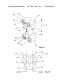 OSTEOTOMY IMPLANT diagram and image