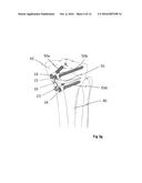 OSTEOTOMY IMPLANT diagram and image