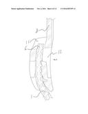 Bone fixation device and method diagram and image