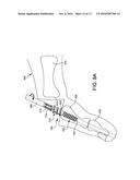 RETROGRADED HAMMERTOE COMPRESSION SCREW IMPLANT AND METHODS OF IMPLANTING     THE SAME diagram and image