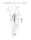 RETROGRADED HAMMERTOE COMPRESSION SCREW IMPLANT AND METHODS OF IMPLANTING     THE SAME diagram and image