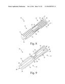 Bone Compression Screws diagram and image