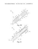 Bone Compression Screws diagram and image