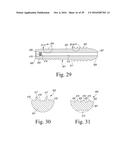 Bone Compression Screws diagram and image