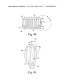 Bone Compression Screws diagram and image