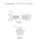 Bone Compression Screws diagram and image