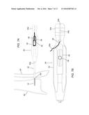 DEVICES, SYSTEMS, AND METHODS FOR SEMI-RIGID BONE FIXATION diagram and image