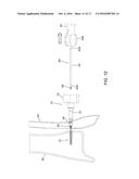 DEVICES, SYSTEMS, AND METHODS FOR SEMI-RIGID BONE FIXATION diagram and image