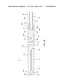 DEVICES, SYSTEMS, AND METHODS FOR SEMI-RIGID BONE FIXATION diagram and image