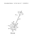 METHOD FOR BALLOON-ASSISTED AUGMENTATION AND FUSION OF ADJACENT VERTEBRAL     BODIES diagram and image