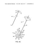 METHOD FOR BALLOON-ASSISTED AUGMENTATION AND FUSION OF ADJACENT VERTEBRAL     BODIES diagram and image