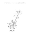 METHOD FOR BALLOON-ASSISTED AUGMENTATION AND FUSION OF ADJACENT VERTEBRAL     BODIES diagram and image