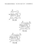 METHOD FOR BALLOON-ASSISTED AUGMENTATION AND FUSION OF ADJACENT VERTEBRAL     BODIES diagram and image