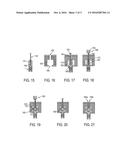 Methods and Devices for Anchoring A Graft to Bone diagram and image