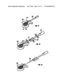 DEVICES FOR DELIVERING BONE FILLER MATERIAL AND ASSOCIATED METHODS OF USE diagram and image