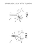 AIRWAY DIAGNOSIS AND TREATMENT DEVICES AND RELATED METHODS OF USE diagram and image