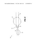 AIRWAY DIAGNOSIS AND TREATMENT DEVICES AND RELATED METHODS OF USE diagram and image