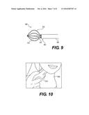 AIRWAY DIAGNOSIS AND TREATMENT DEVICES AND RELATED METHODS OF USE diagram and image