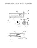 CRYOTHERAPY SPRAY DEVICE diagram and image