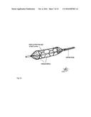 Drug Device Electroporation System diagram and image