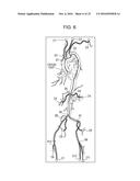 MEDICAL IMAGE DISPLAY APPARATUS, DISPLAY CONTROL METHOD THEREFOR, AND     NON-TRANSITORY RECORDING MEDIUM diagram and image