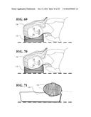 SUPPORT PILLOWS AND MATTRESSES FOR BODY ALIGNMENT diagram and image