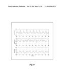 TIME AND FREQUENCY DOMAIN BASED ACTIVITY TRACKING SYSTEM diagram and image