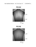 IMAGE PROCESSING APPARATUS, IMAGE PROCESSING SYSTEM, IMAGE PROCESSING     METHOD, AND RECORDING MEDIUM diagram and image