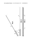 ENDOSCOPIC STAPLER diagram and image