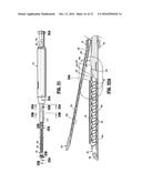 ENDOSCOPIC STAPLER diagram and image