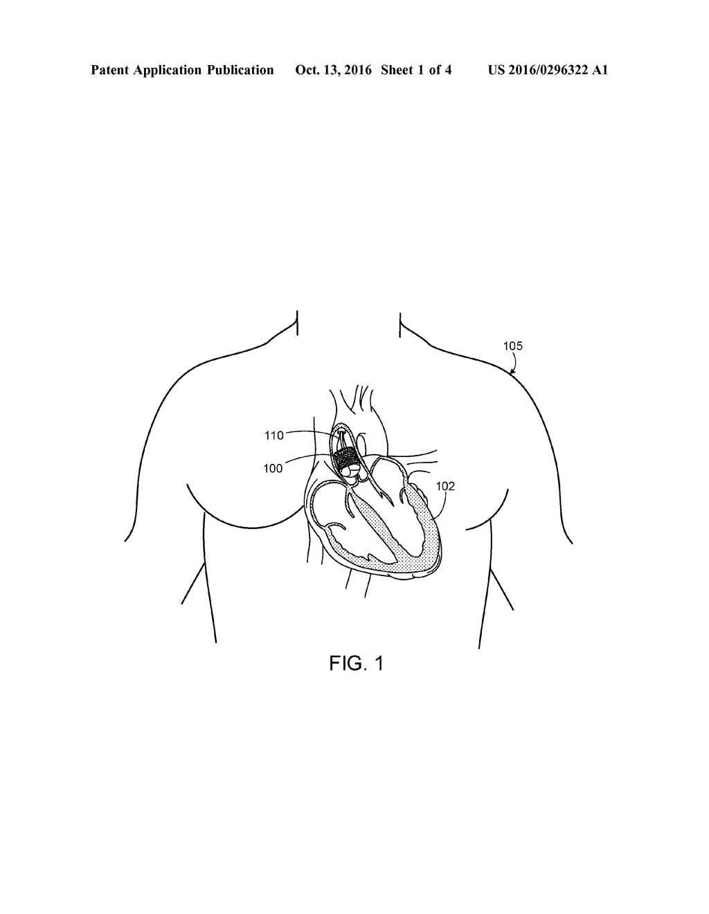 SYNTHETIC HEART VALVES COMPOSED OF ZWITTERIONIC POLYMERS - diagram, schematic, and image 02