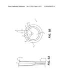 EXPANDABLE SHEATH WITH ELASTOMERIC CROSS SECTIONAL PORTIONS diagram and image