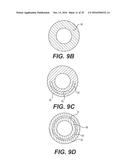 EXPANDABLE SHEATH WITH ELASTOMERIC CROSS SECTIONAL PORTIONS diagram and image