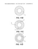 EXPANDABLE SHEATH WITH ELASTOMERIC CROSS SECTIONAL PORTIONS diagram and image