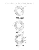 EXPANDABLE SHEATH WITH ELASTOMERIC CROSS SECTIONAL PORTIONS diagram and image