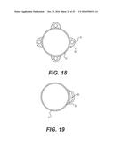 EXPANDABLE SHEATH WITH ELASTOMERIC CROSS SECTIONAL PORTIONS diagram and image