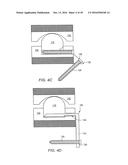 EXPANDABLE ARTICULATING INTERVERTEBRAL IMPLANT WITH LIMITED ARTICULATION diagram and image