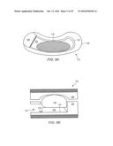 EXPANDABLE ARTICULATING INTERVERTEBRAL IMPLANT WITH LIMITED ARTICULATION diagram and image