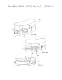 EXPANDABLE ARTICULATING INTERVERTEBRAL IMPLANT WITH LIMITED ARTICULATION diagram and image