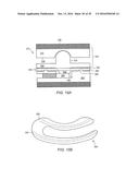 EXPANDABLE ARTICULATING INTERVERTEBRAL IMPLANT WITH LIMITED ARTICULATION diagram and image