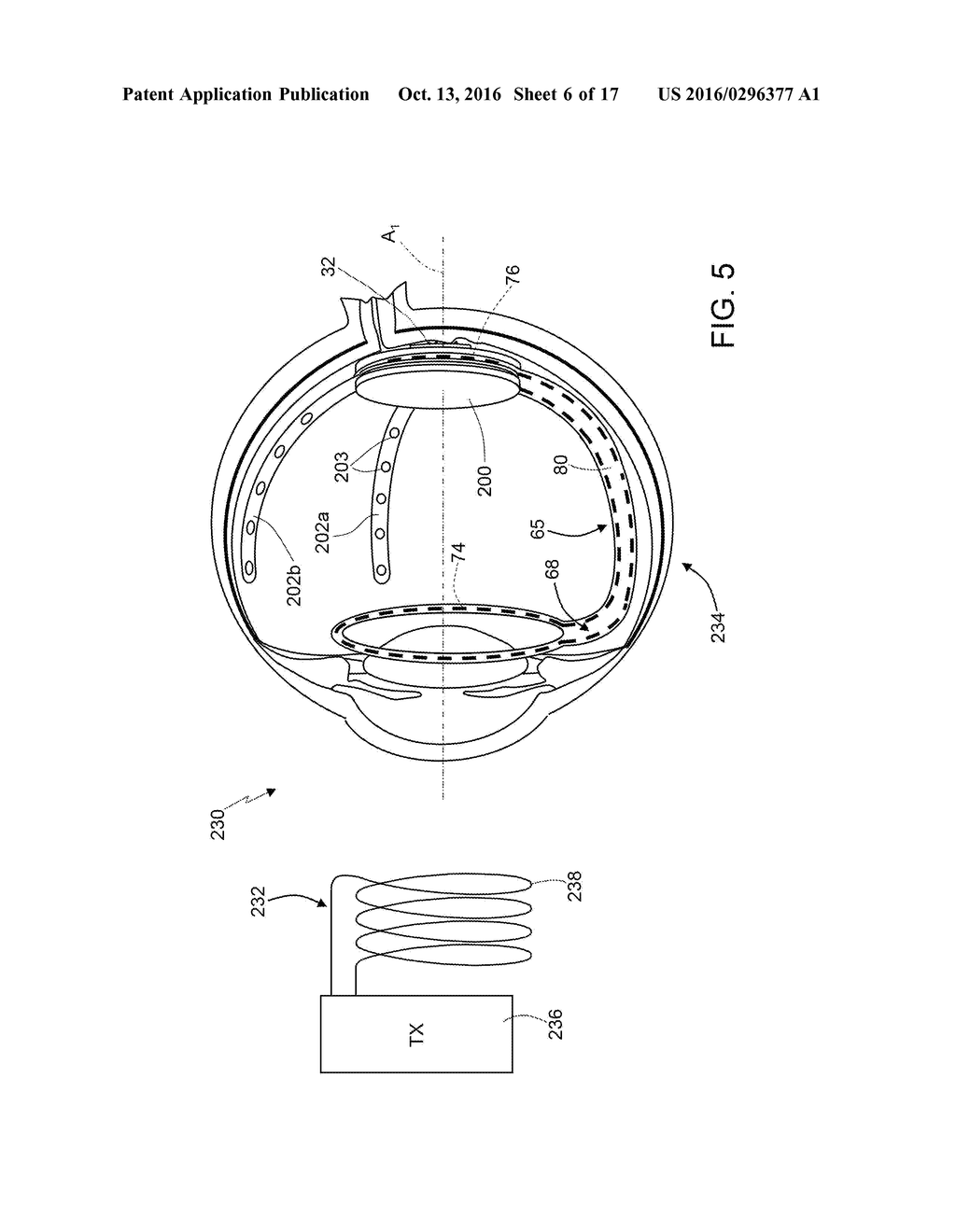 IMPLANTABLE MODULAR SYSTEM FOR A SYSTEM FOR ELECTRICALLY STIMULATING A     BIOLOGICAL TISSUE - diagram, schematic, and image 07