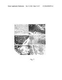 LACTOBACILLUS PLANTARUM INDUCIA DSM 21379 AS ENHANCER OF CELLULAR     IMMUNITY, HYPOCHOLESTEROLEMIC AND ANTI-OXIDATIVE AGENT AND ANTIMICROBIAL     AGENT AGAINST CLOSTRIDIUM DIFFICILE diagram and image